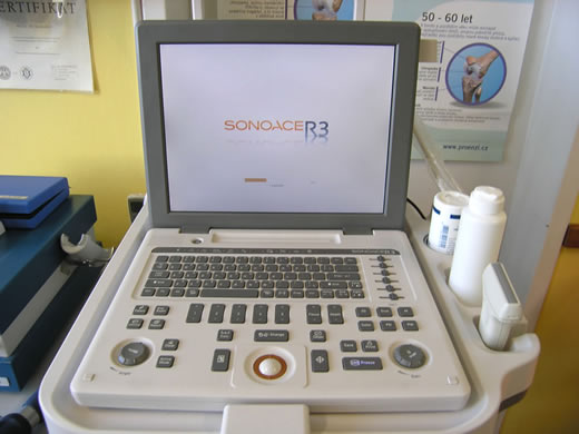 Ultrazvukový přístroj pro sonografické vyšetření kloubů