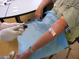 Odběr krevní plazmy pro léčení metodou PRP